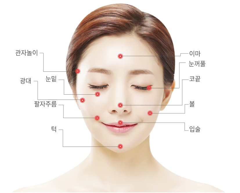 지방이식 시술 부위 다이어그램 - 이마, 관자놀이, 눈밑, 눈꺼풀, 코끝, 광대, 볼, 팔자주름, 입술, 턱