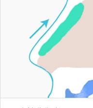 植入 단계 일러스트