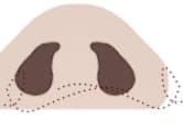 STEP 6 - 縫合